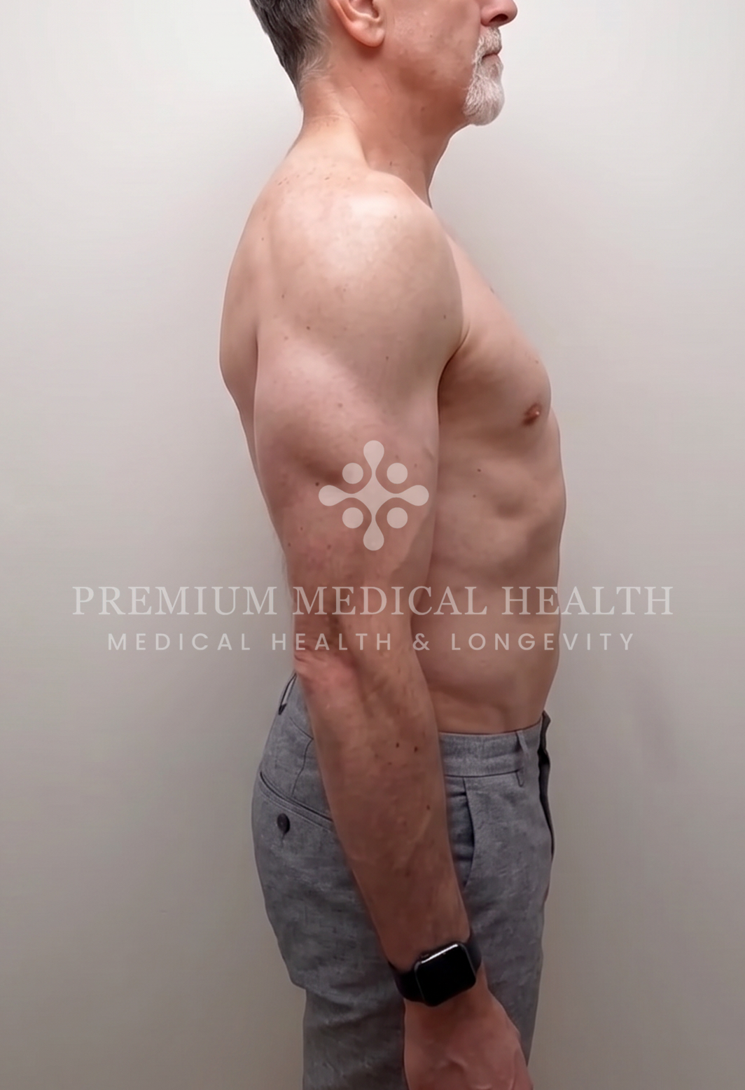 Steve, lateral post-protocol