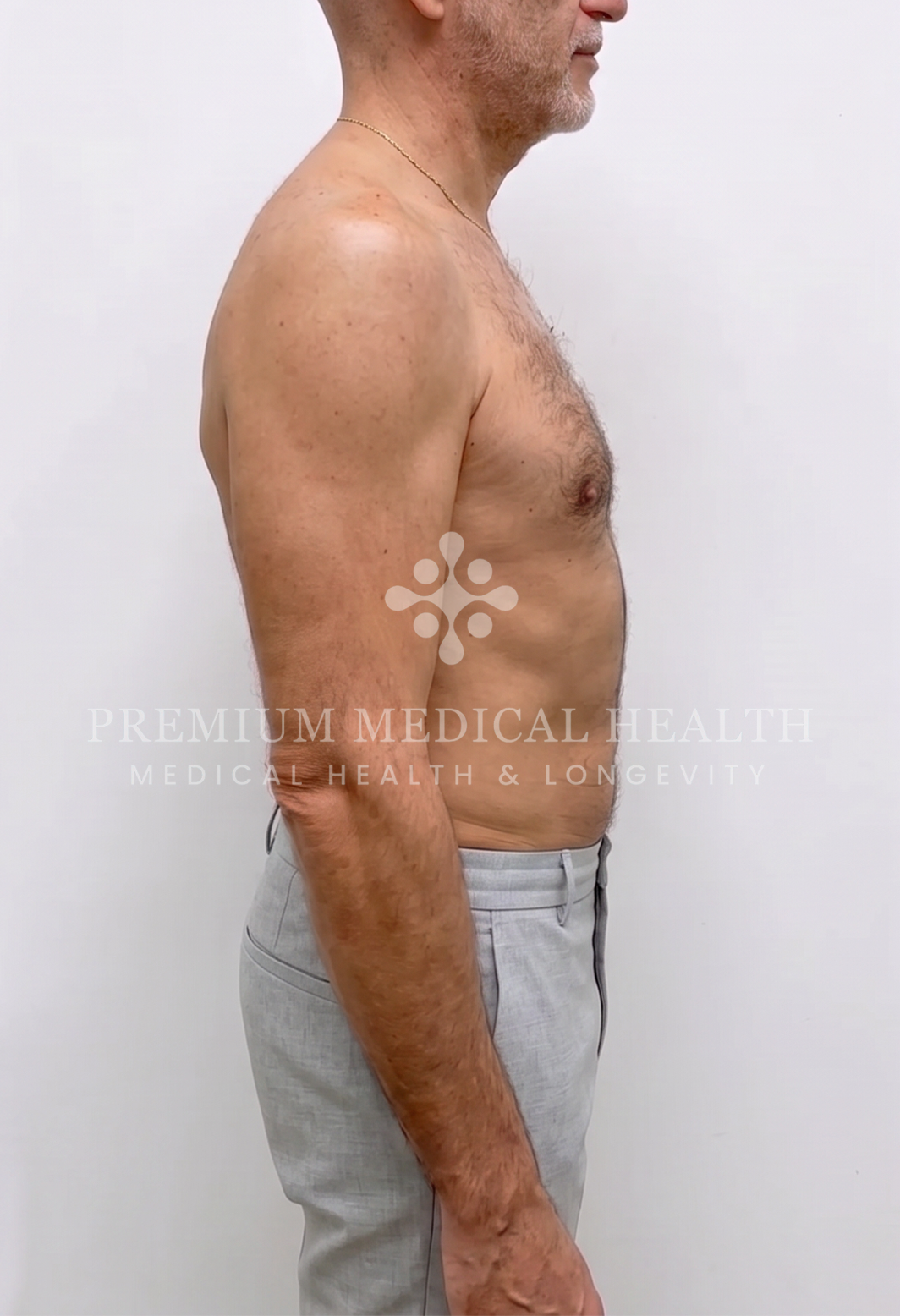 Mark Manymneh, lateral baseline