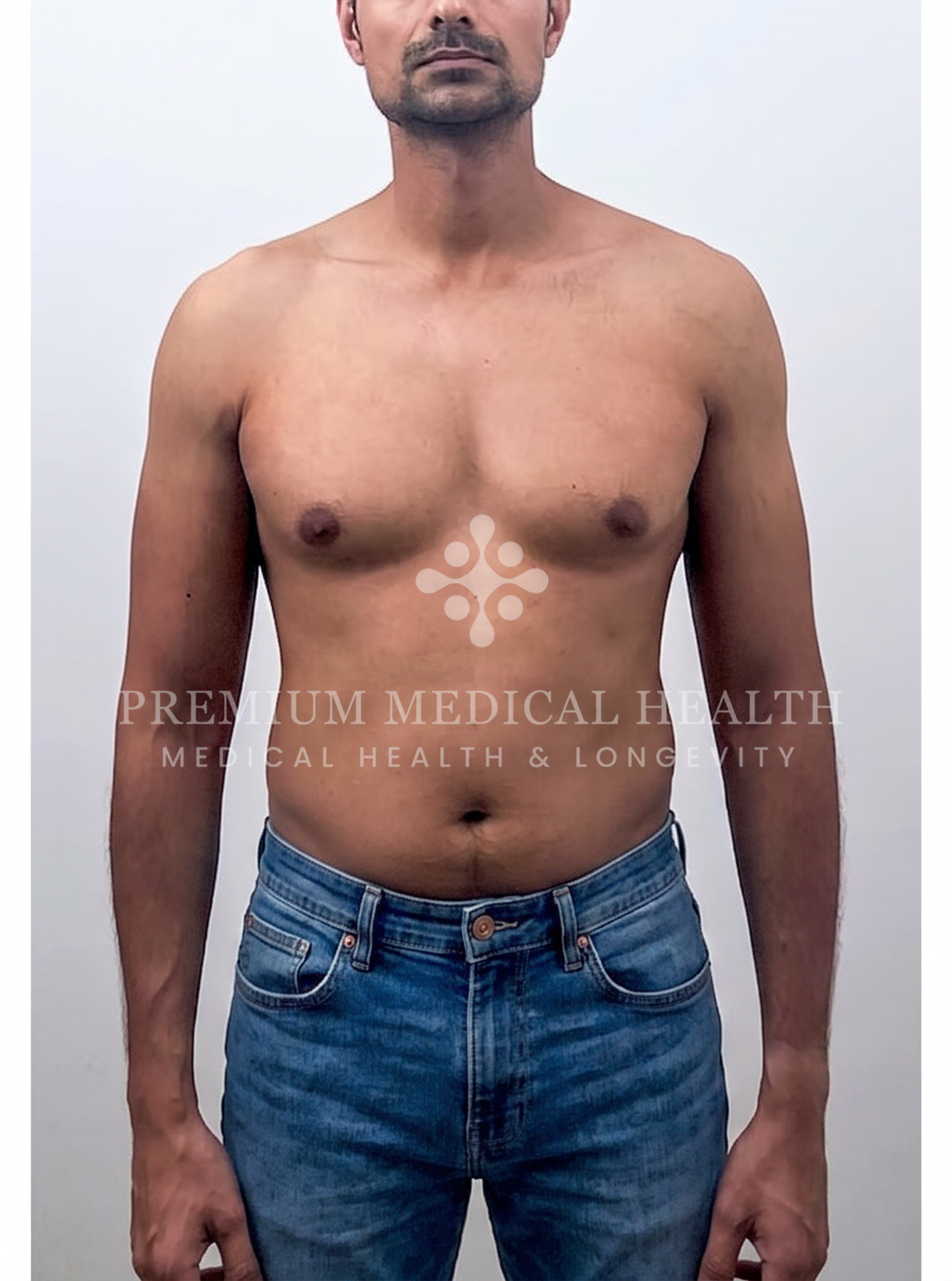 Abdulla — Body Recomposition, before