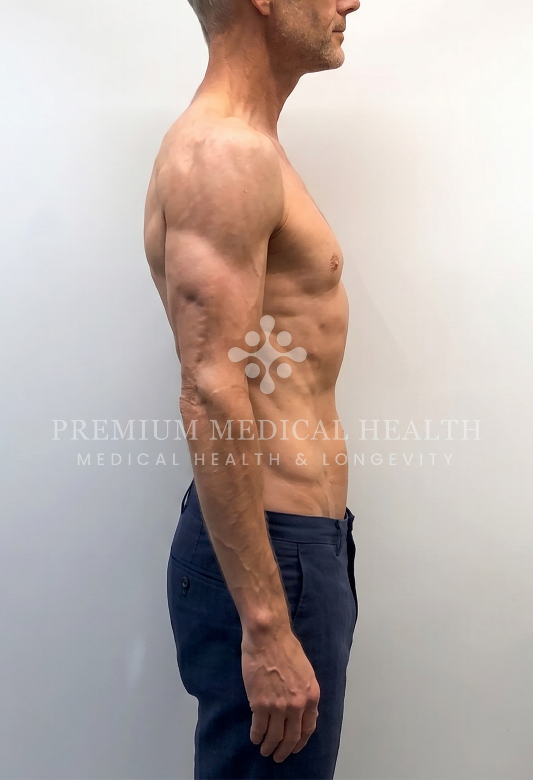 Hady, lateral post-protocol