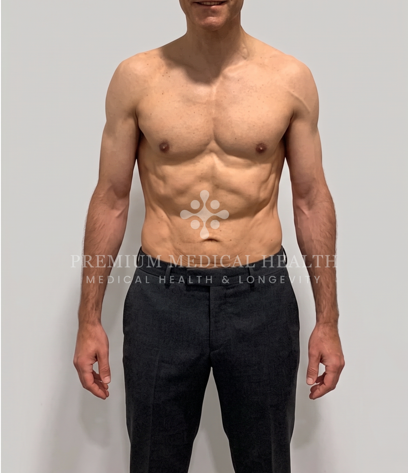 Abed, Biological Age Reversal & Epigenetic Optimization