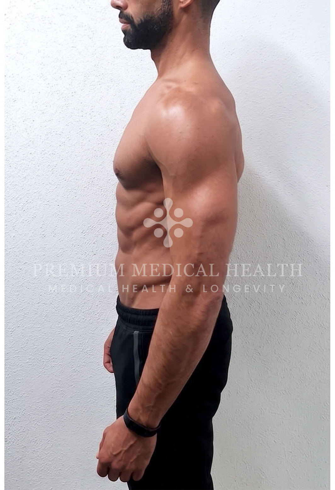 Mustapha, lateral post-protocol
