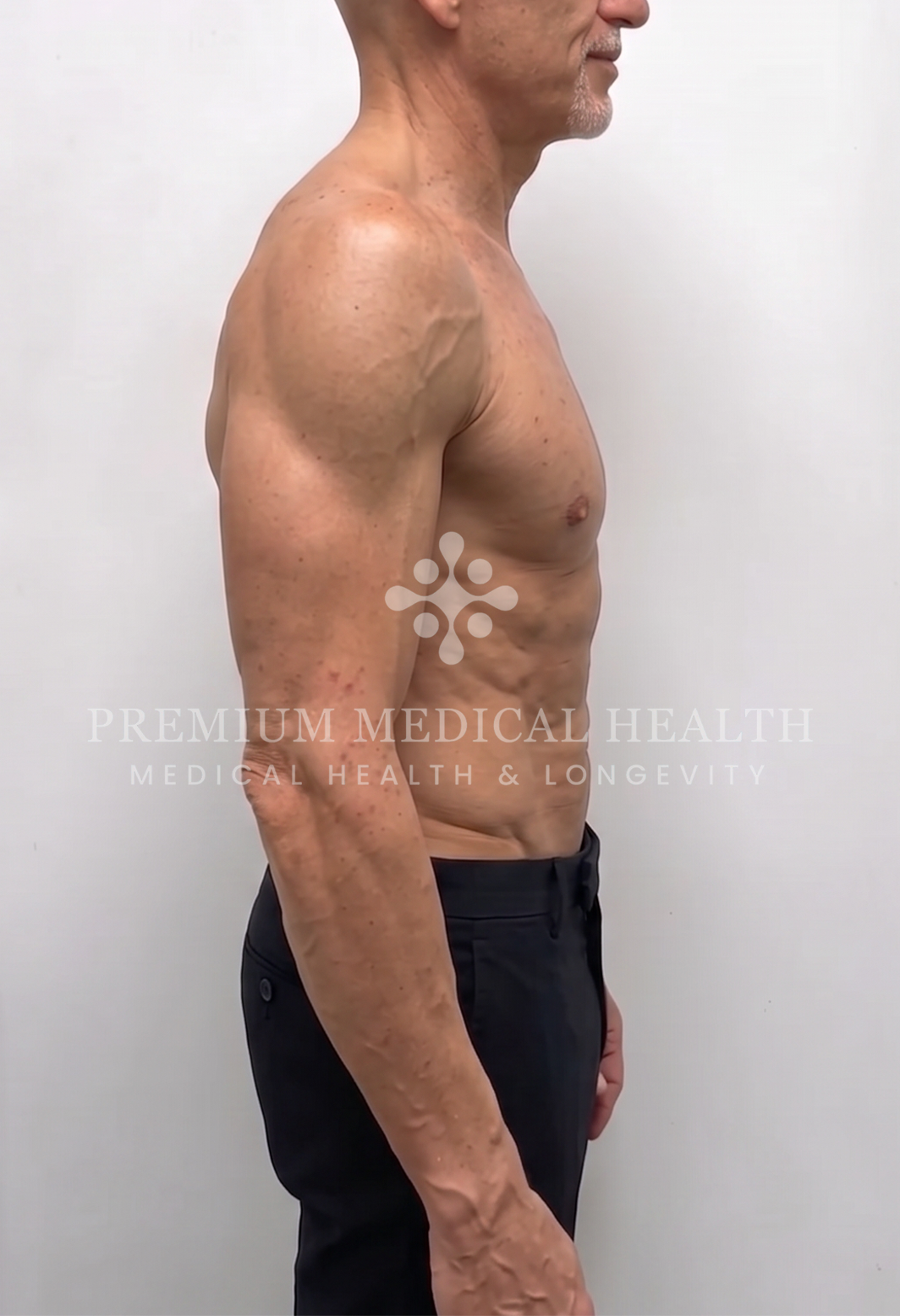 Mark Manymneh, lateral post-protocol