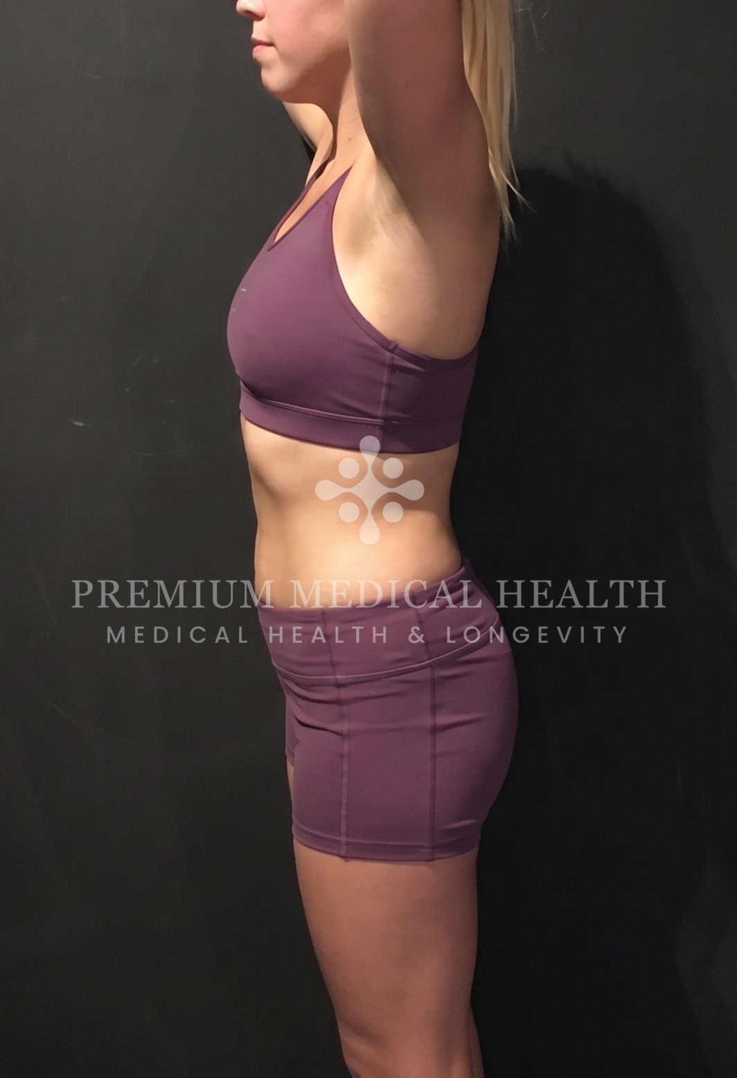Chloe, lateral post-protocol