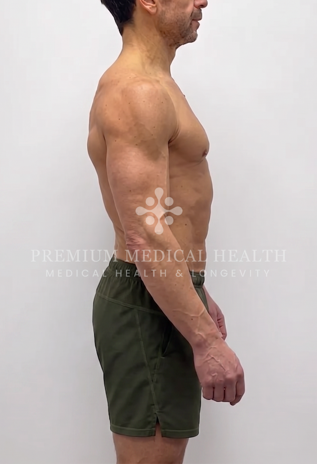 Omar, lateral post-protocol