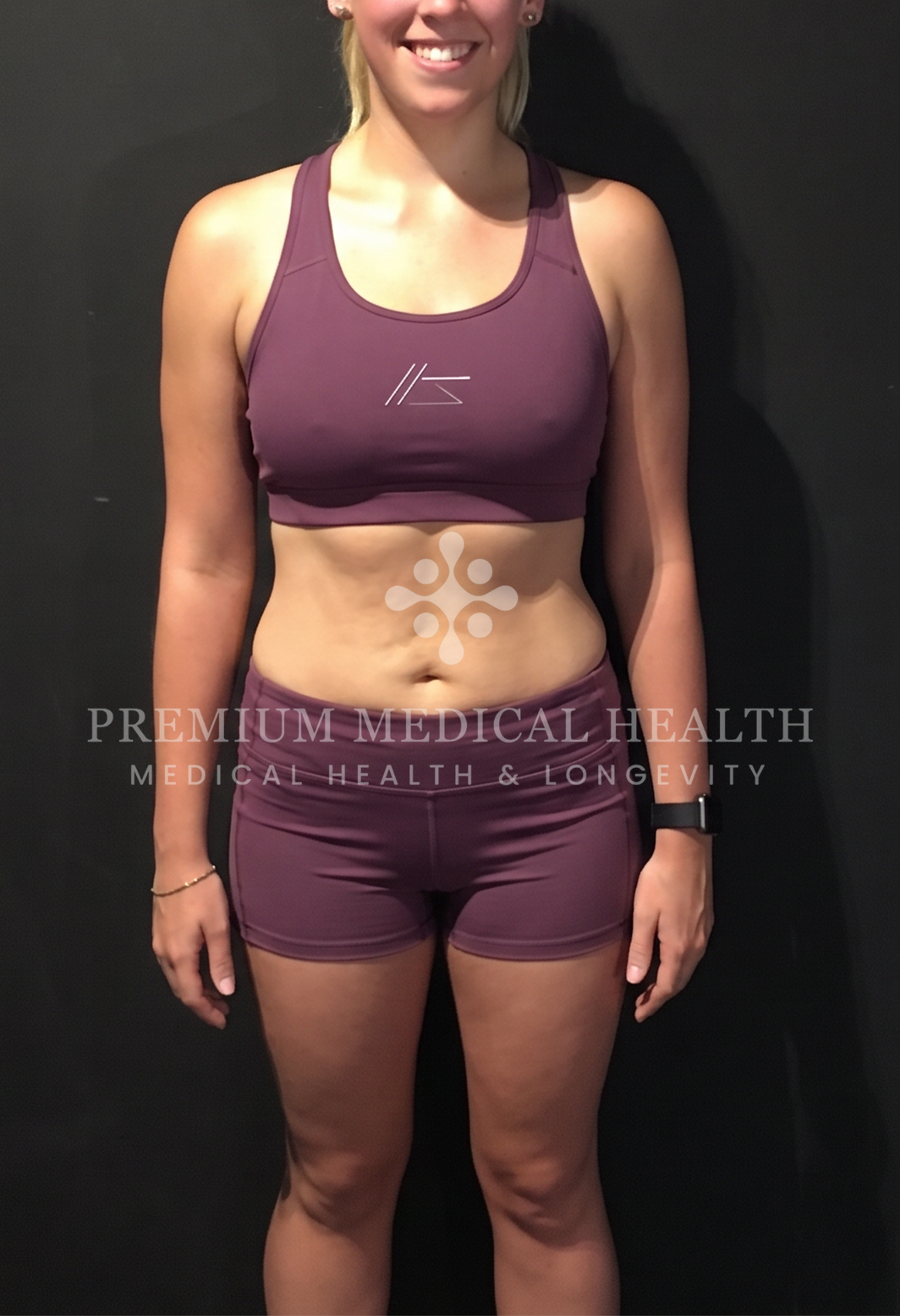 Chloe, PCOS Metabolic Restoration & Insulin Re-Sensitization