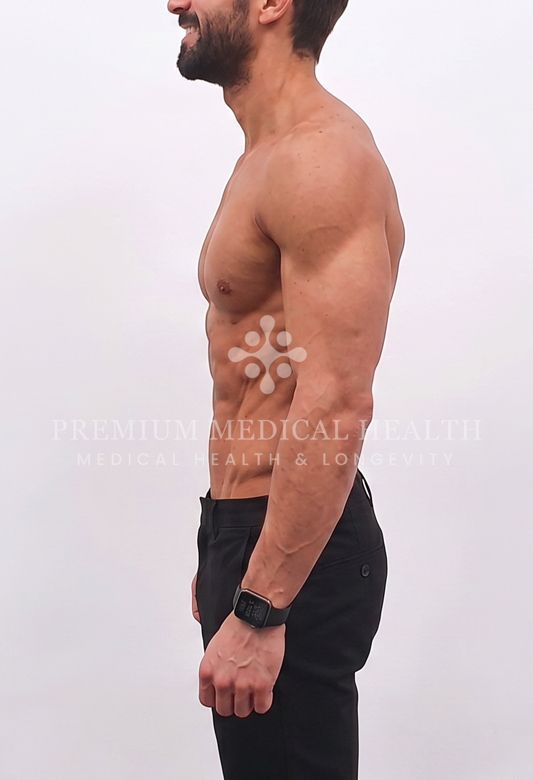 George, lateral post-protocol